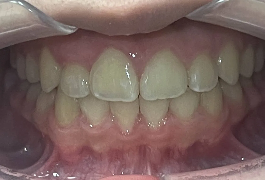 Case 09 after treatment