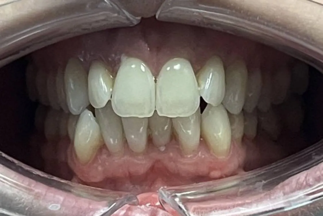 Case 10 before treatment