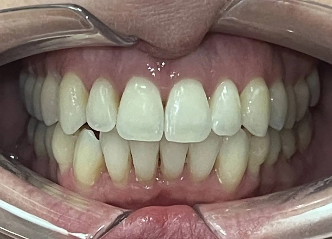 Case 10 after treatment