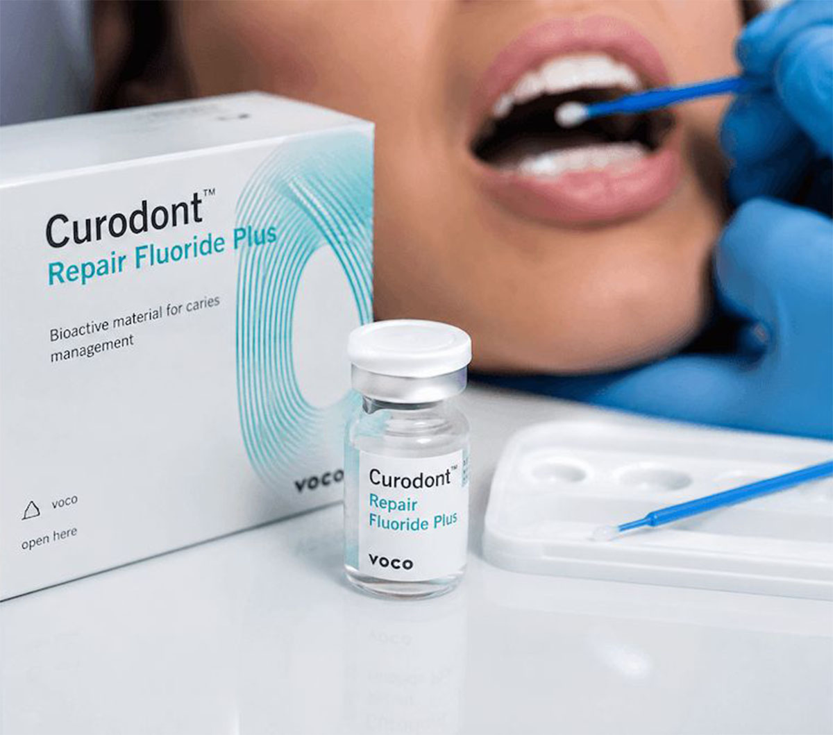 A close-up view of a dental treatment scene showing a person with an open mouth undergoing application of a dental product using a blue applicator. In the foreground, a small clear vial and a box labeled 'Curodont Repair Fluoride Plus' bioactive material for caries management by VOCO are displayed.