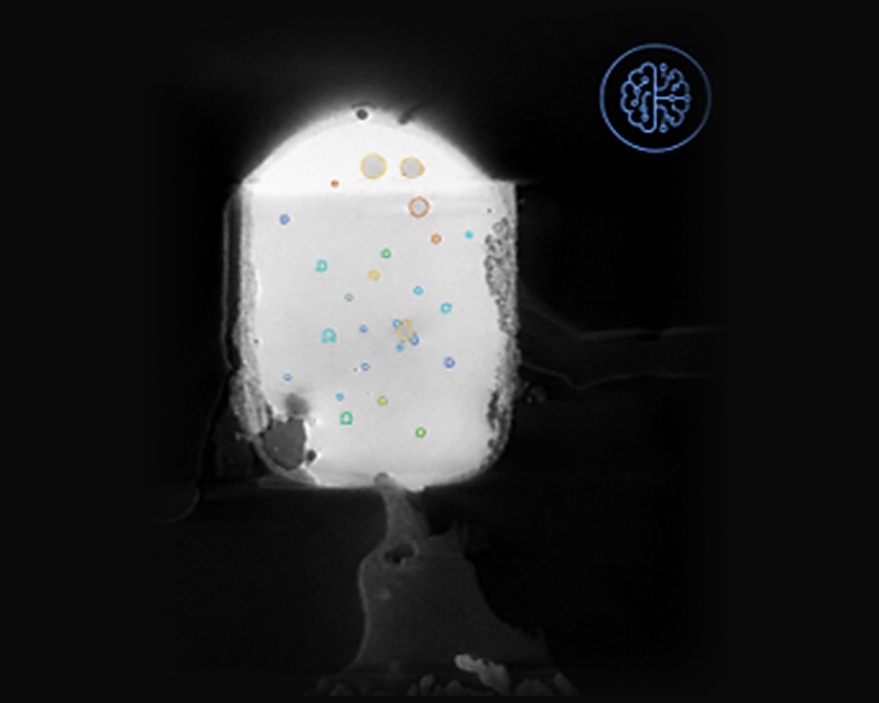 AI-based automatic segmentation of inclusions in an X-ray image
