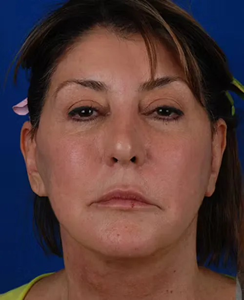 Close-up of a middle-aged woman with short brown hair against a blue background.