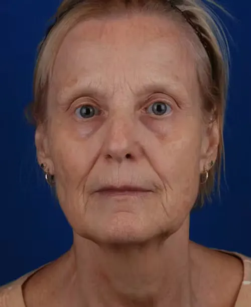 Close-up portrait of an elderly woman with light skin and blond hair against a dark blue background.