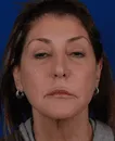 Close-up of a middle-aged woman with light skin, dark hair, neutral expression, and wearing small hoop earrings.