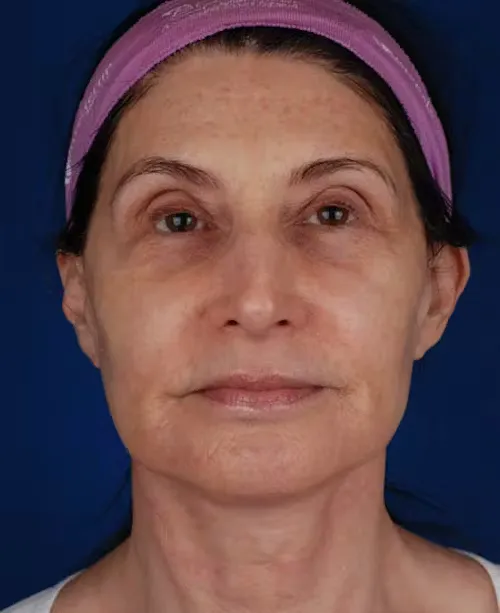 Close-up of a middle-aged woman wearing a pink headband with a neutral expression against a dark blue background.