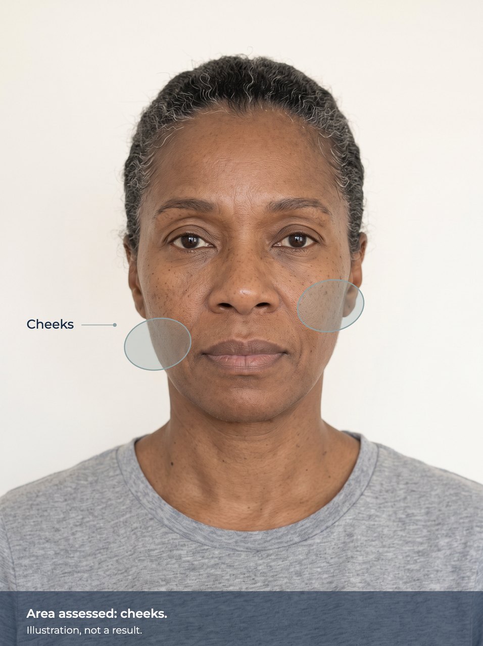 Illustration of the cheeks marked on a face. Illustration, not a result.