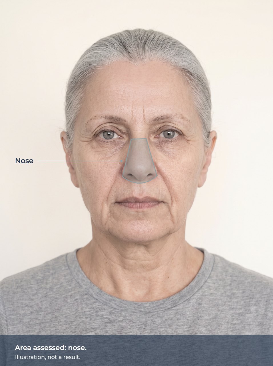 Illustration of the nose marked on a face. Illustration, not a result.