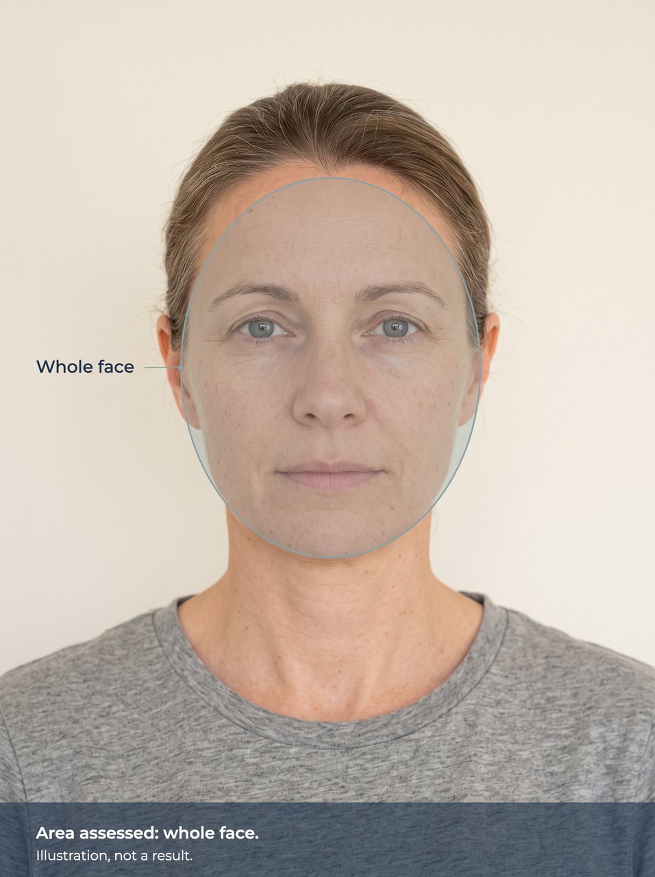 Illustration of the whole face marked. Illustration, not a result.