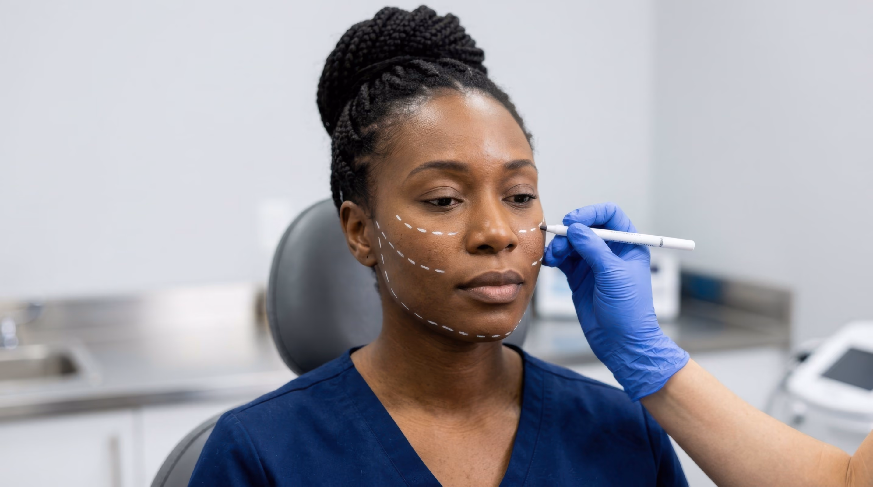A woman with braided hair sitting in a clinic chair while a medical professional wearing blue gloves marks lines on her face with a white pen, indicating areas for a cosmetic procedure.