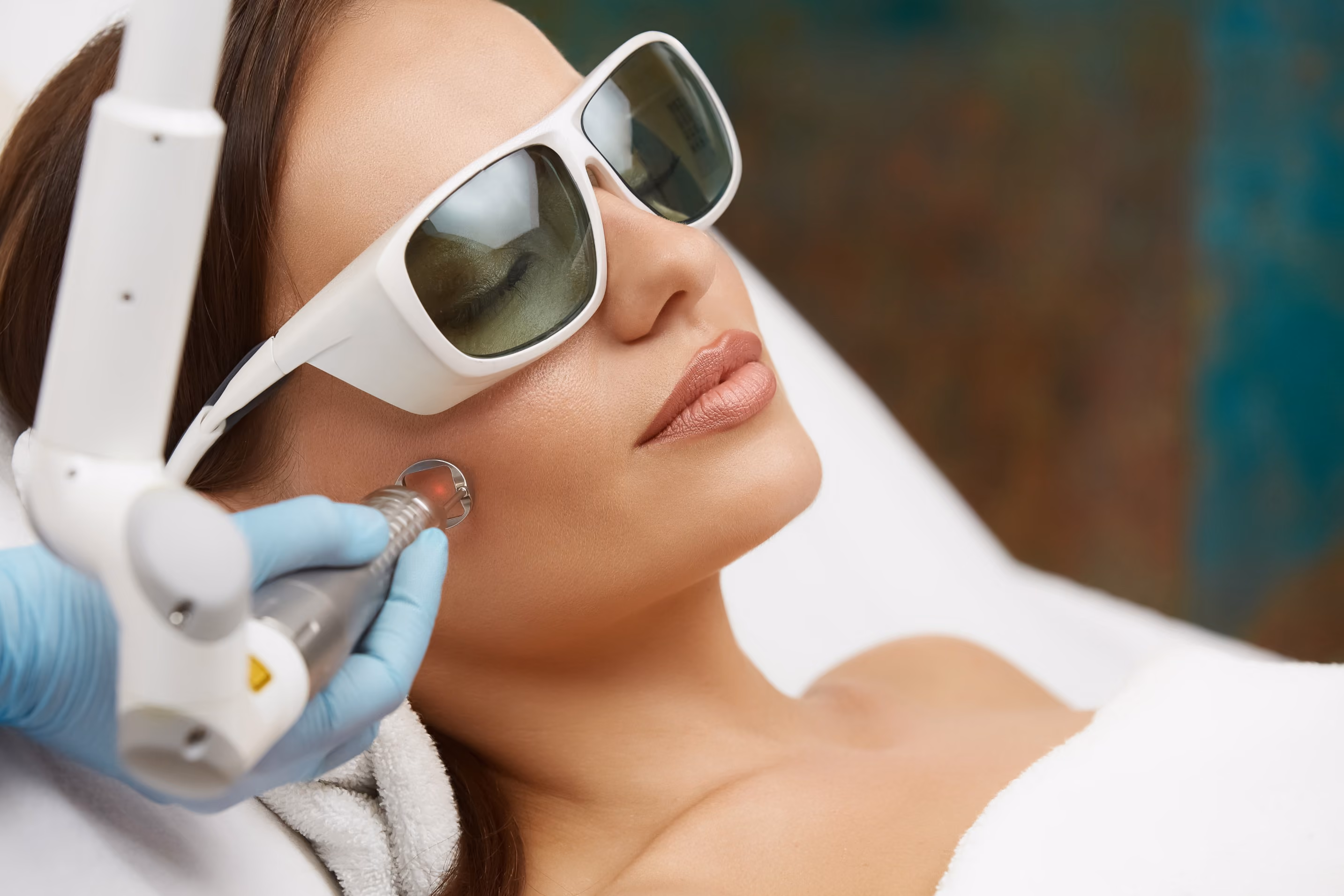 Woman wearing protective glasses receiving a laser skin treatment on her cheek by a gloved practitioner.