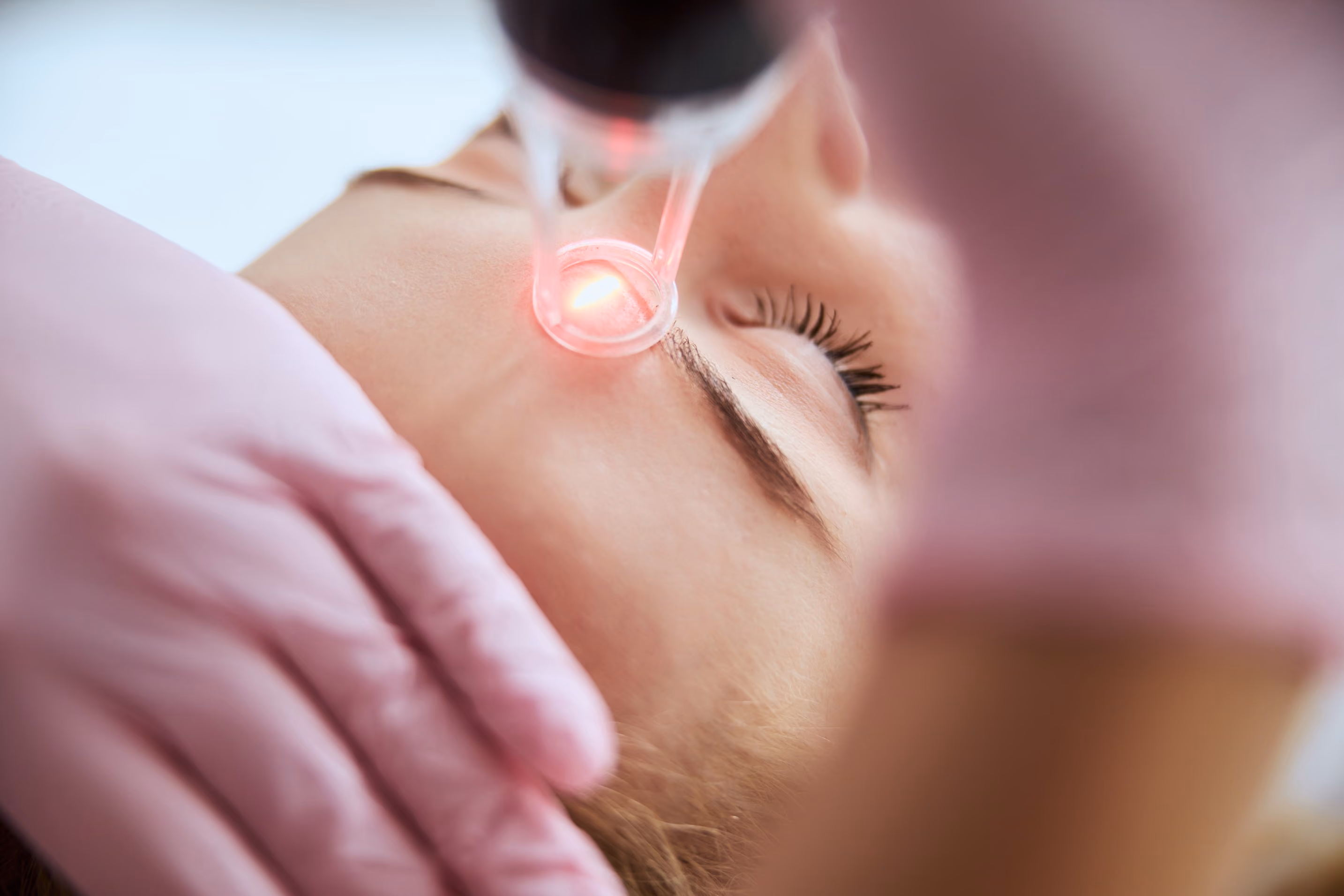 Close-up of a woman receiving a facial laser treatment near her eyebrow with a red light, performed by a person wearing pink gloves.