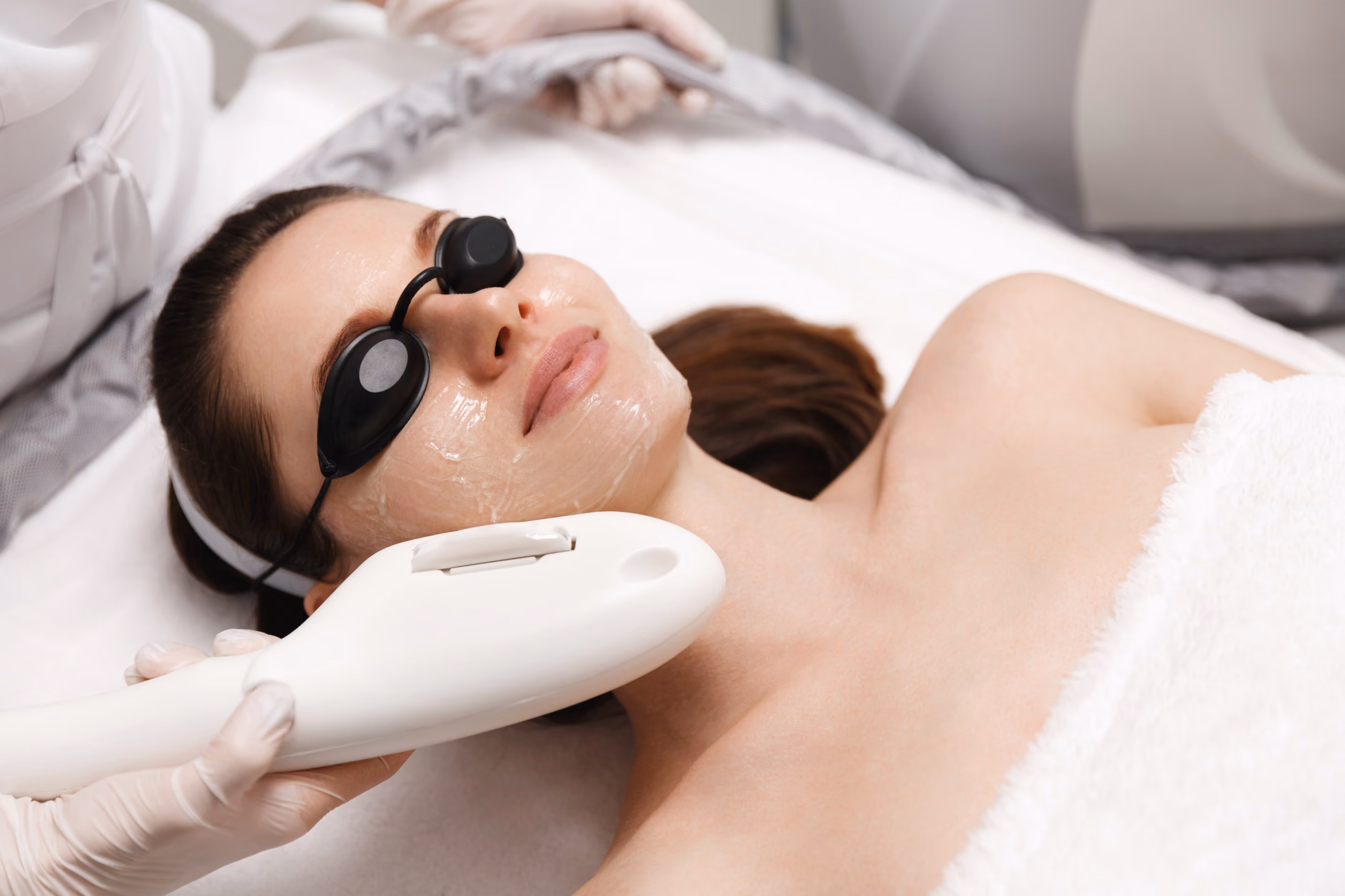 Woman wearing protective goggles lying down with a clear gel mask on her face receiving a cosmetic laser treatment on her cheek.