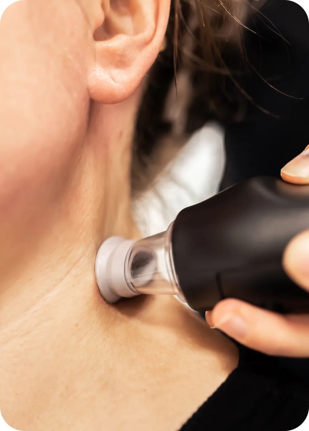 LymphaTouch Pro handpiece and treatment cup on the neck