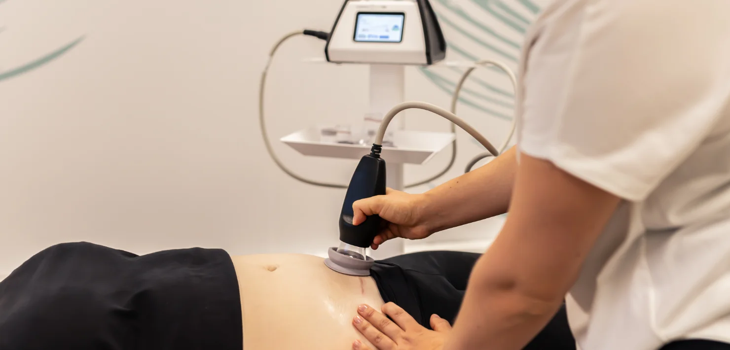 Scar treatment with negative pressure