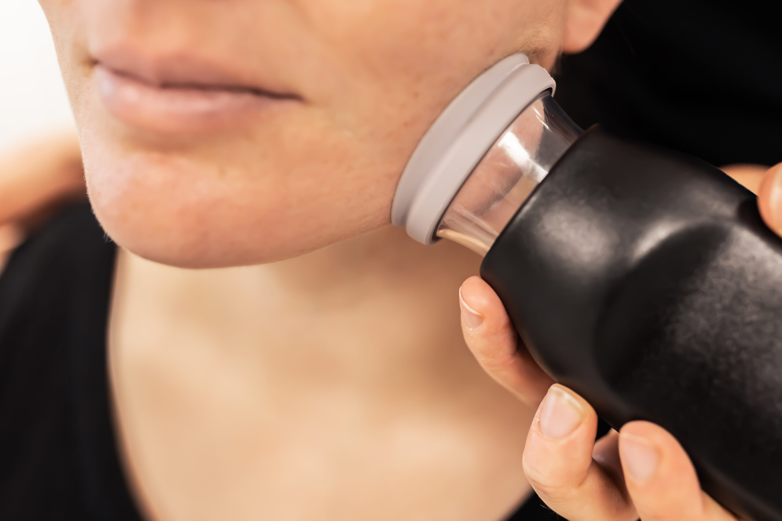 Masseter treatment with LymphaTouch