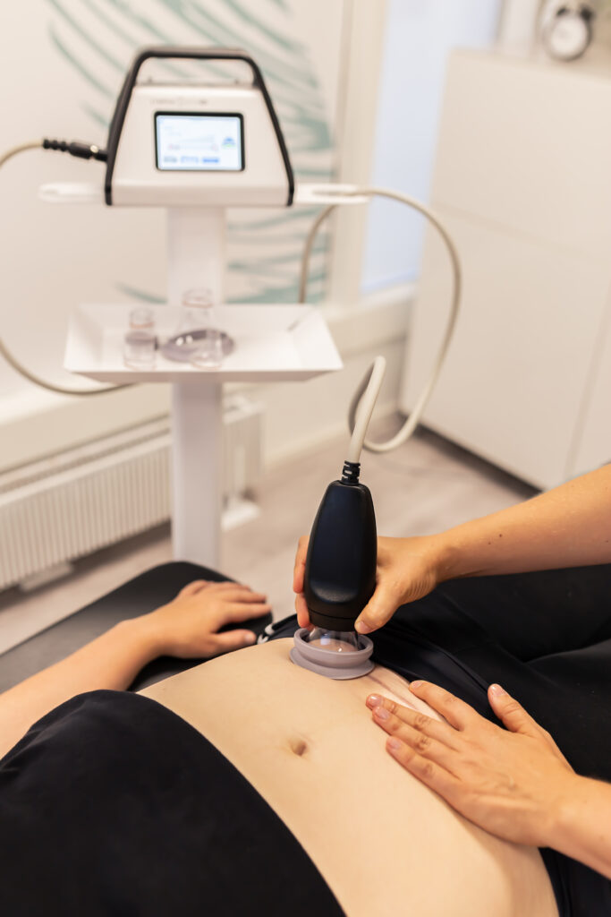 Women's health physiotherapist treating a C-section scar with LymphaTouch