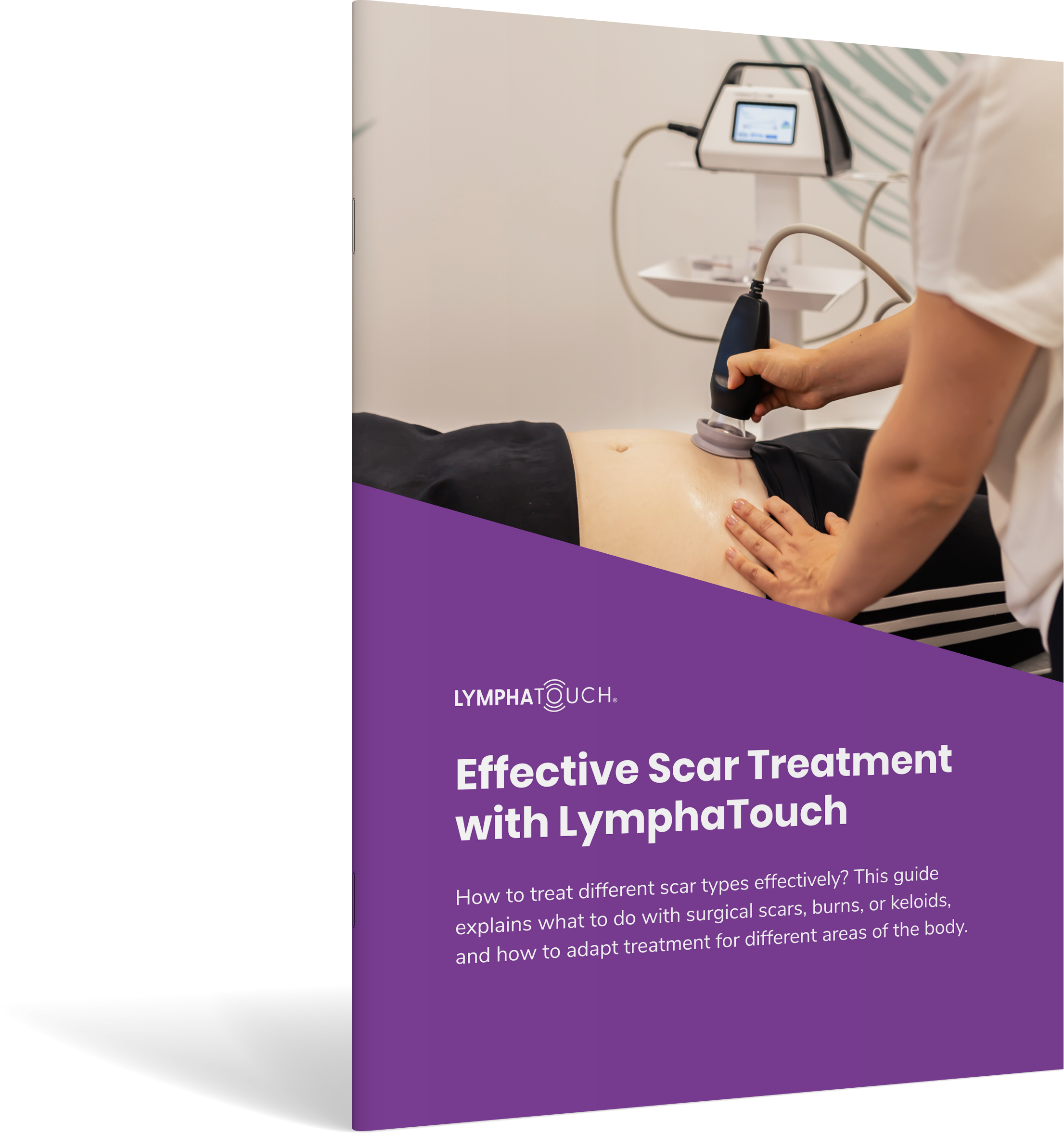 Cover of the Effective scar treatment with LymphaTouch guide