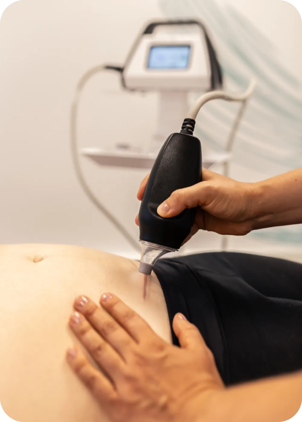 Therapist treating a scar on the lower abdomen with a LymphaTouch handpiece