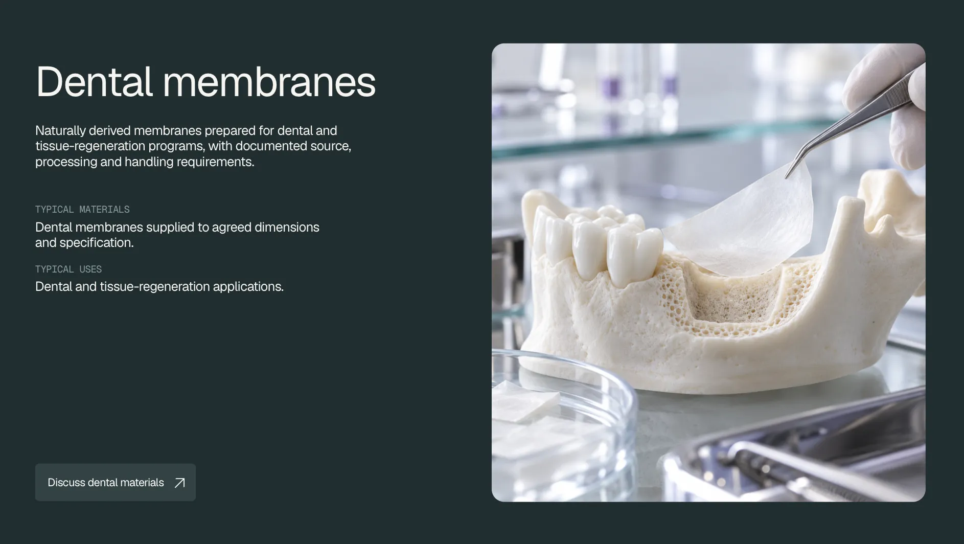 Dental membrane being positioned on a jaw model
