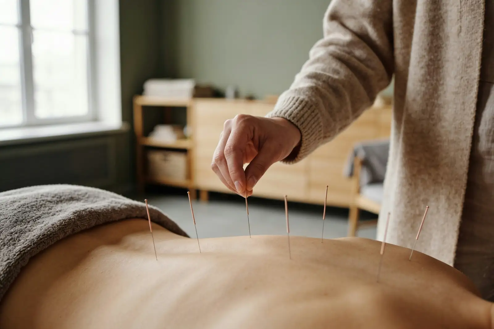Practitioner giving an acupuncture treatment in a calm clinic room