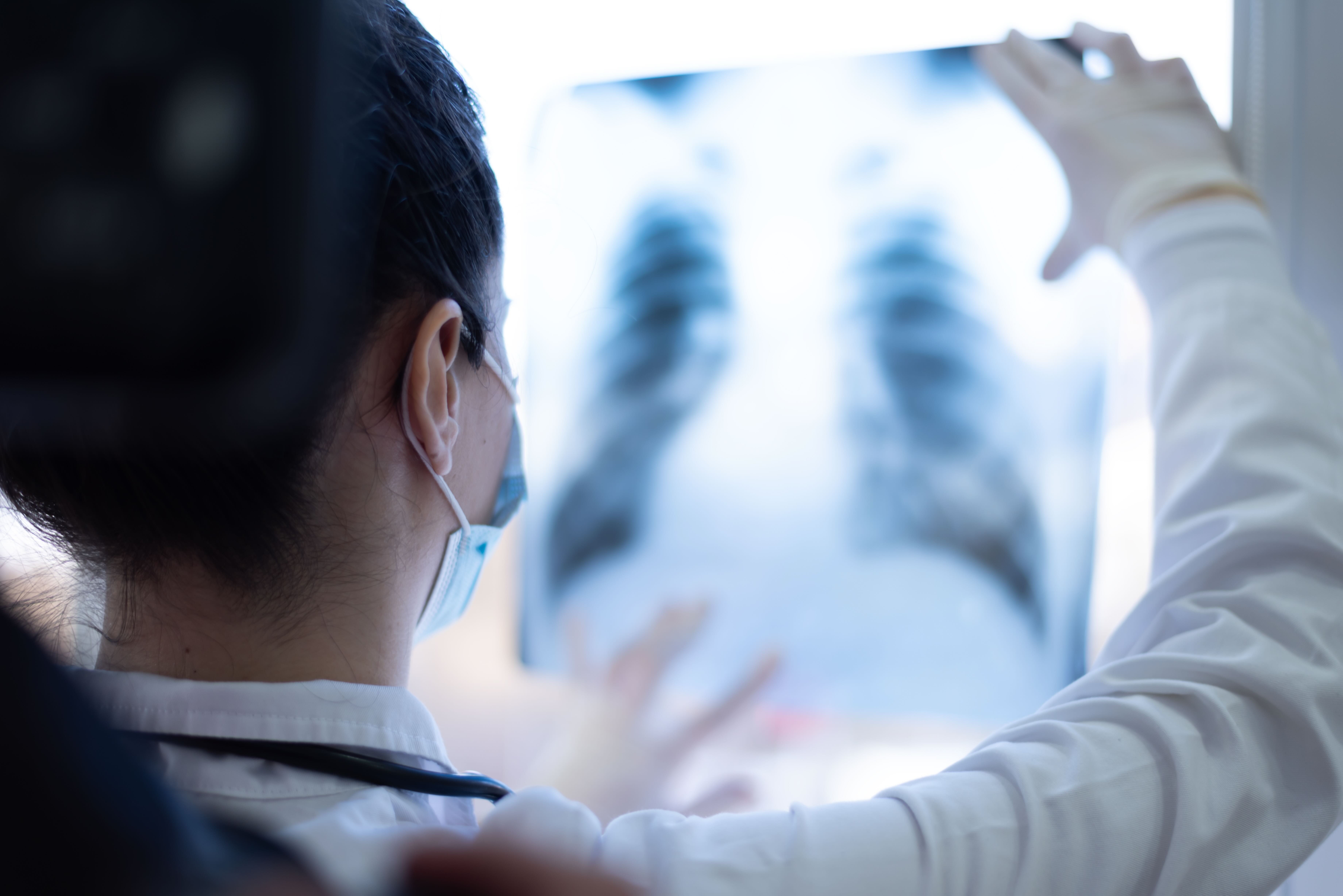 Routine chest CT screening — illustrative healthcare image