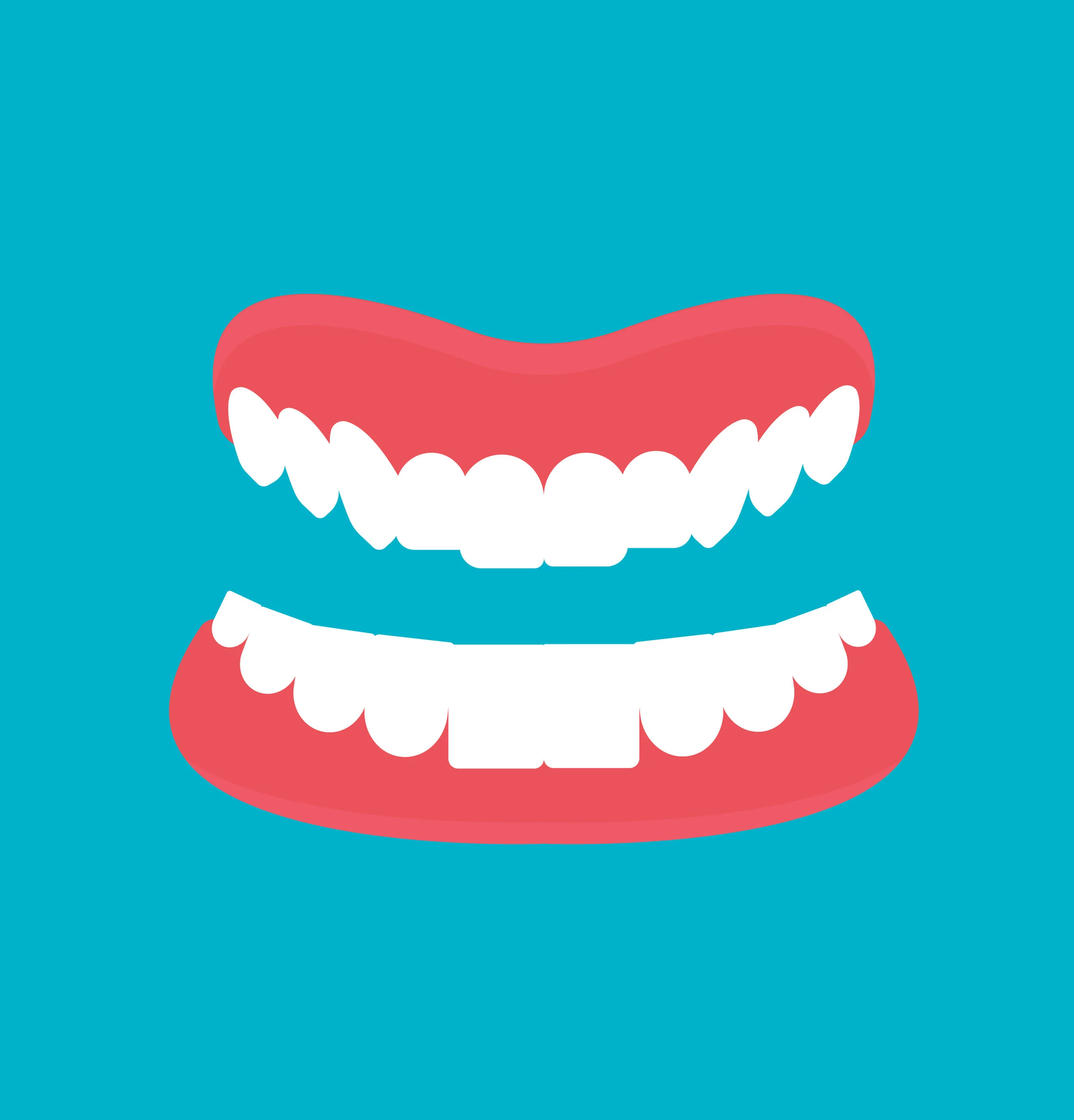 Dental Implants vs Dentures in Jupiter, FL