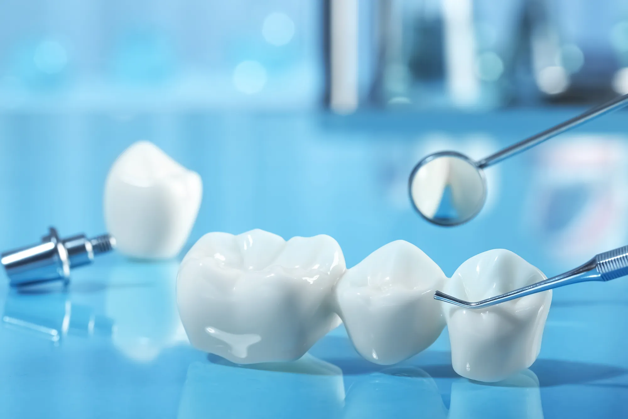 Ceramic crown, bridge and implant abutment with a dental mirror and probe