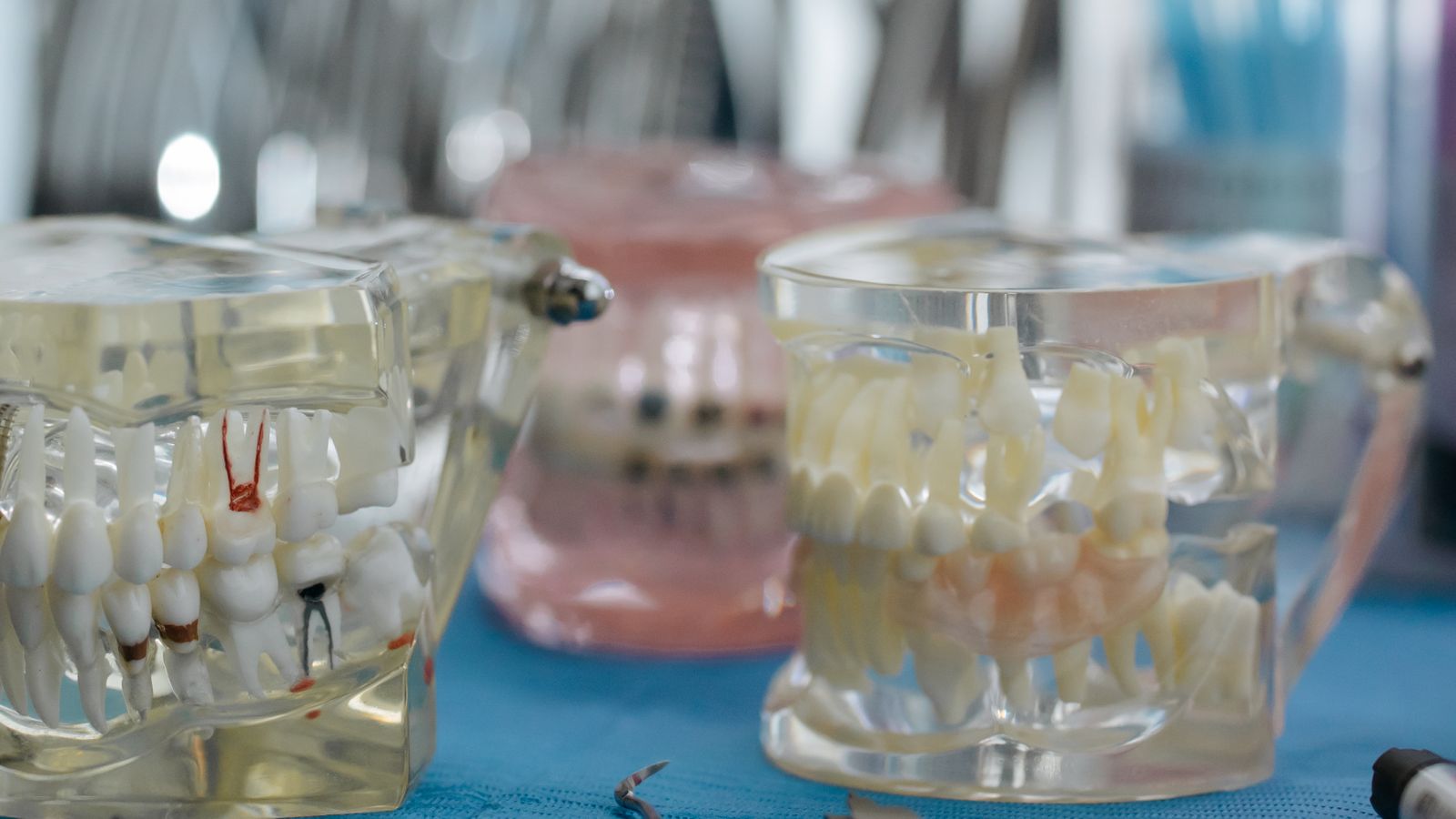Dental models with teeth arrangement on a table