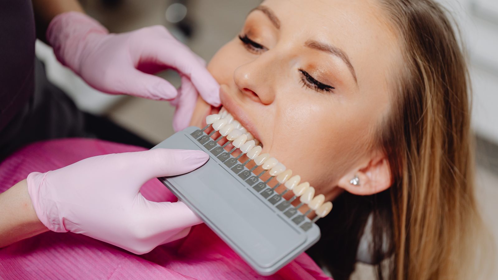 Dental shade guide being used to match tooth color during a hygiene procedure