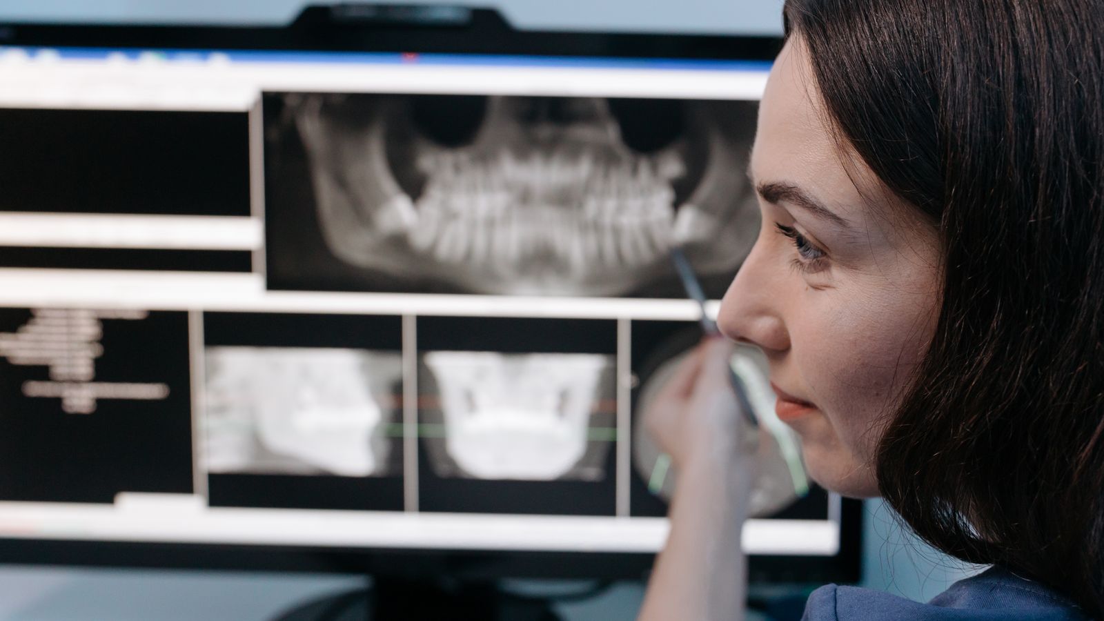 Female dentist reviewing digital dental x-rays on a computer screen in a clinic setting