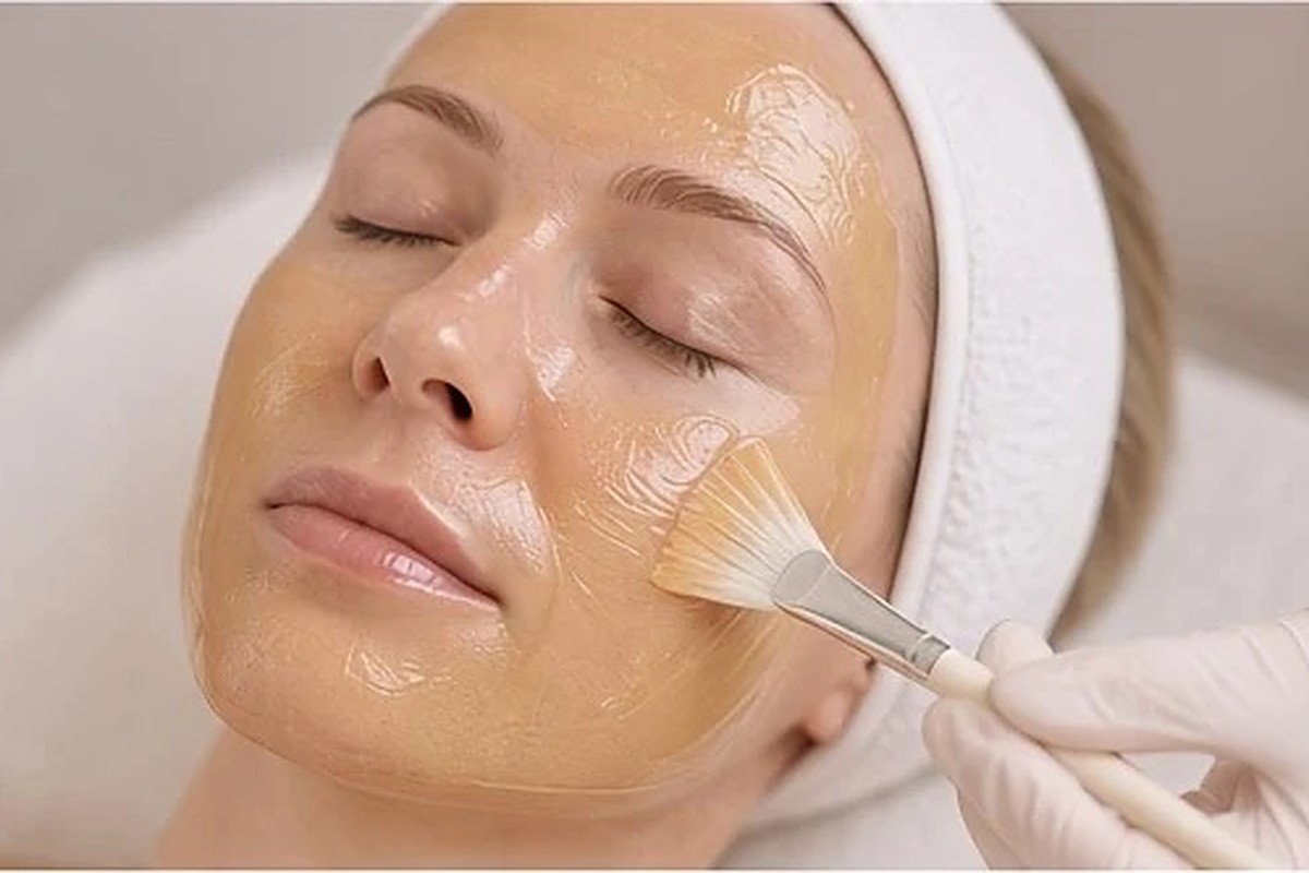 Retinol peel at NewskinLA in Burbank