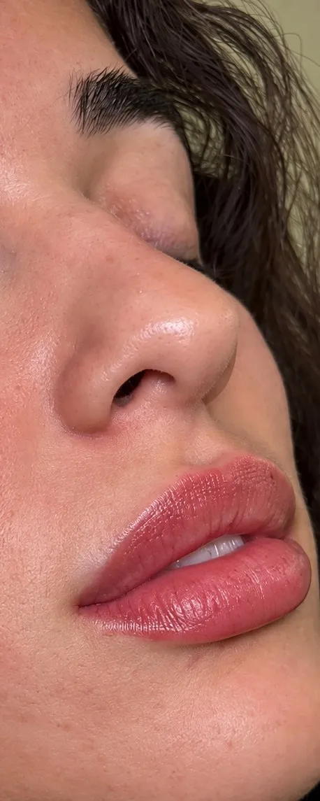 Before lip filler at Cosmetica Med Spa, side profile of lips