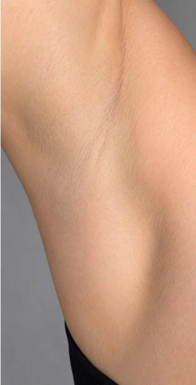 After laser hair removal at Cosmetica Med Spa, smooth hair-free underarm