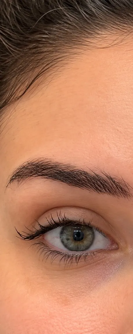 After Botox at Cosmetica Med Spa, smooth forehead