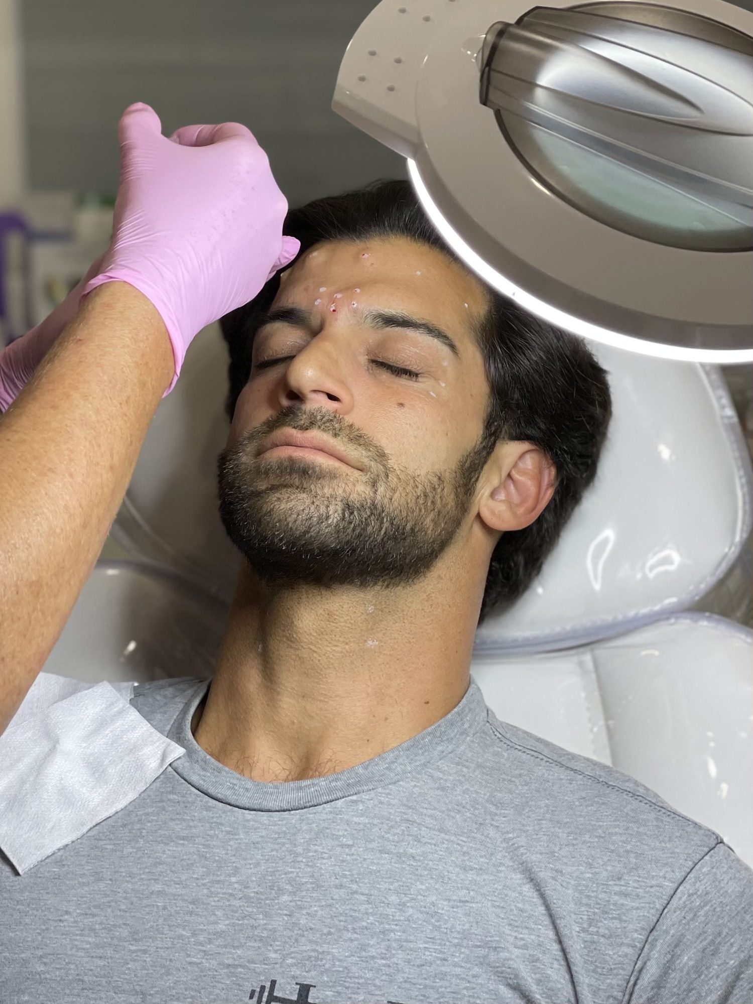 Man receiving Botox injections in the forehead at Cosmetica Med Spa