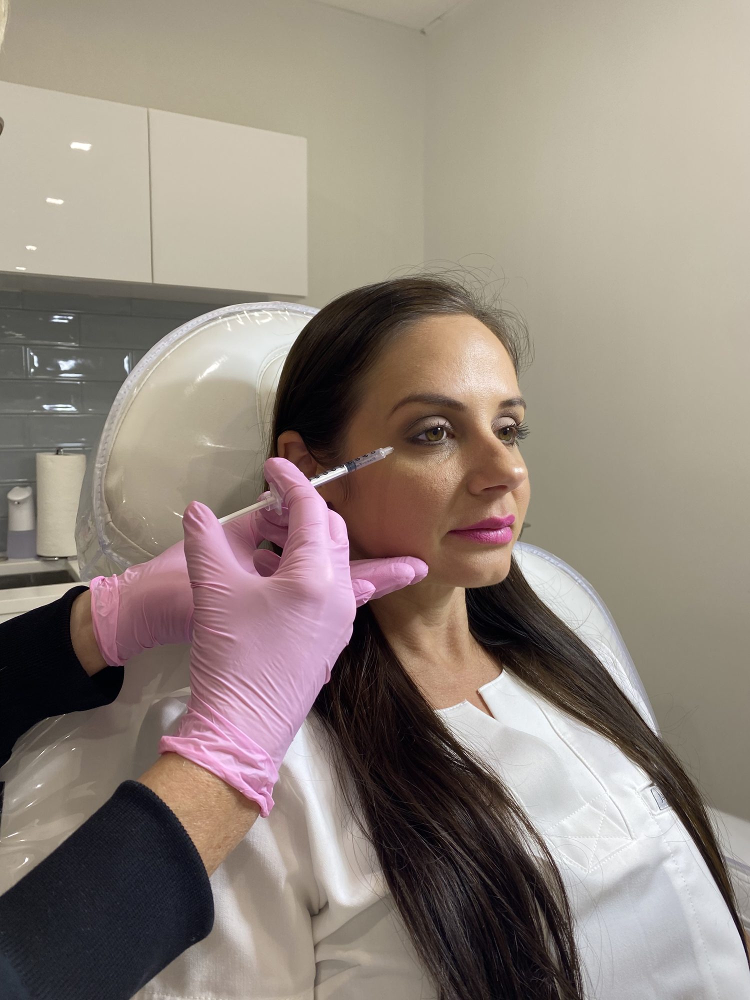 Botox injection for crow's feet at Cosmetica Med Spa in Boca Raton