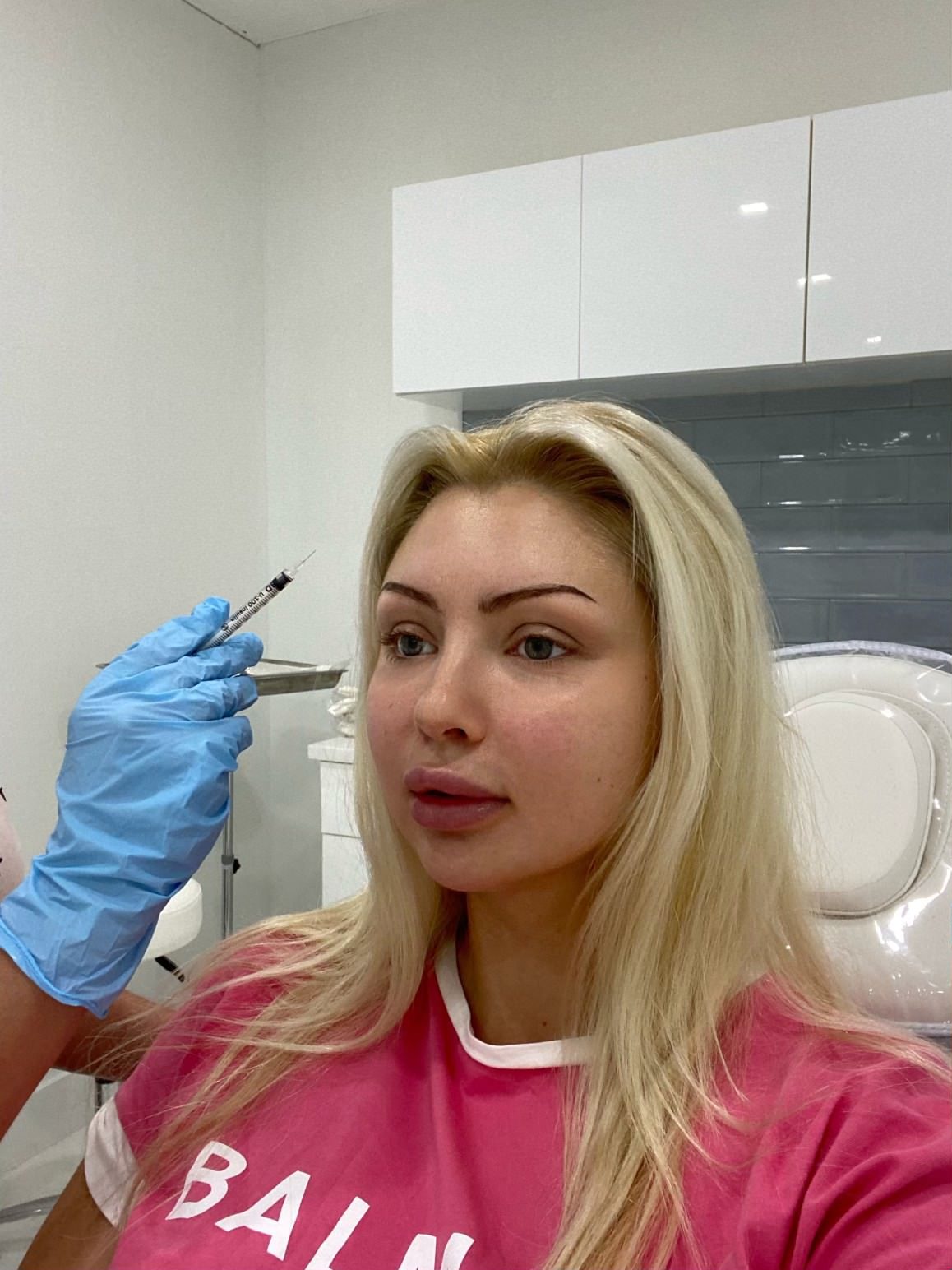 Client in the treatment chair before Botox at Cosmetica Med Spa