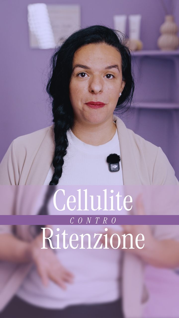 Cellulite o ritenzione idrica alle gambe: come riconoscerle