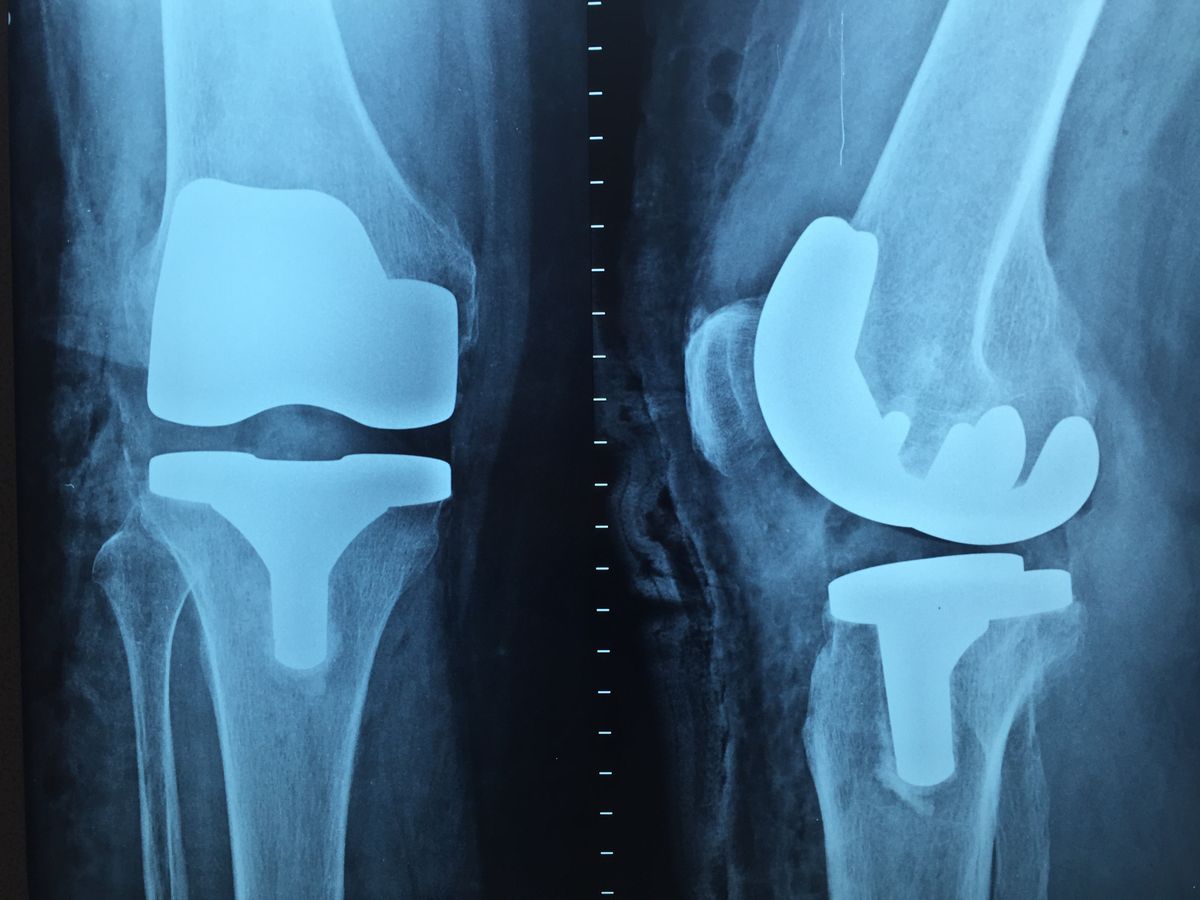 Orthopaedics