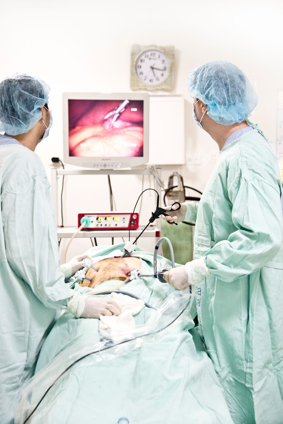 Laparoscopic Cholecystectomy (Gallbladder Removal)