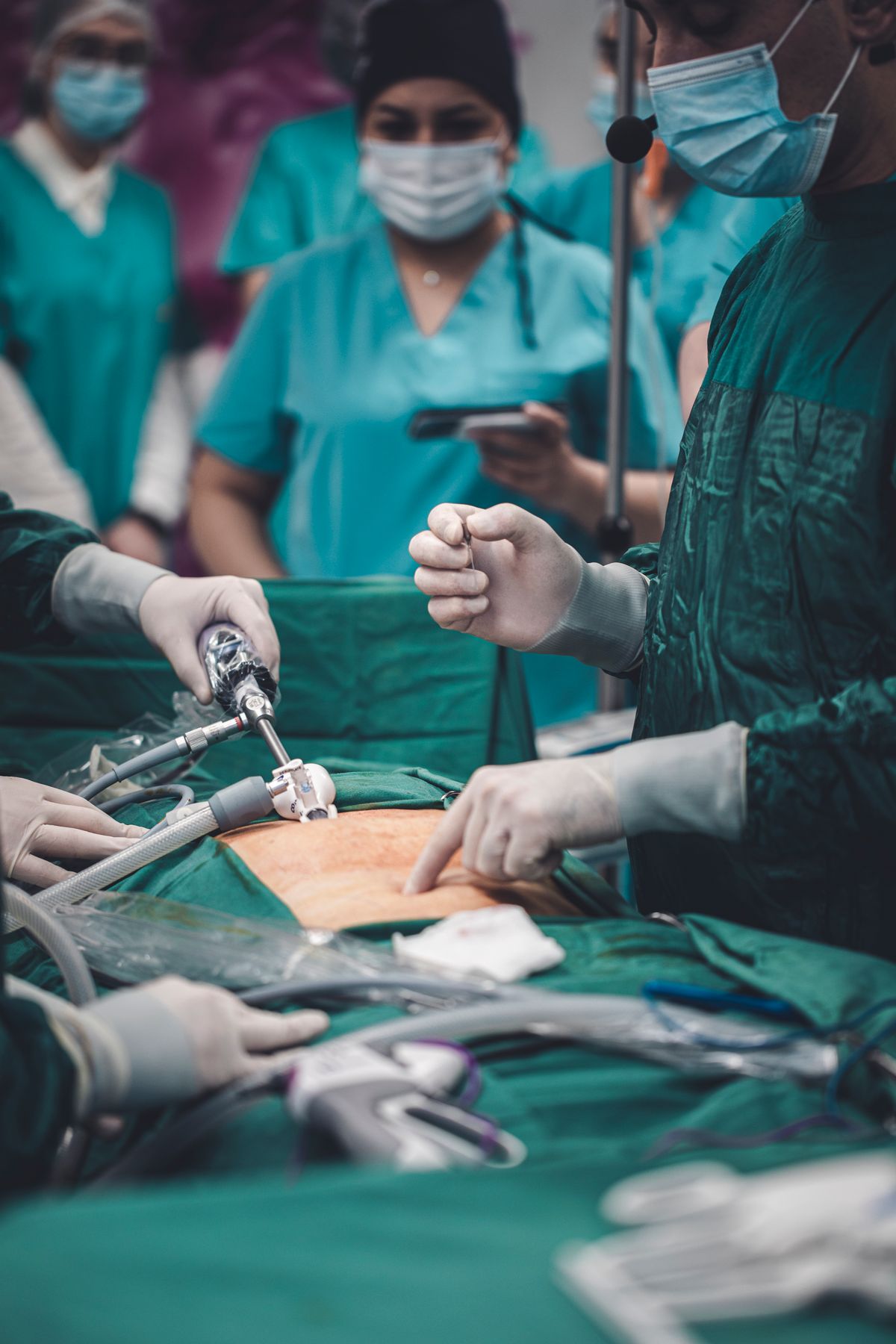 Whipple’s Surgery