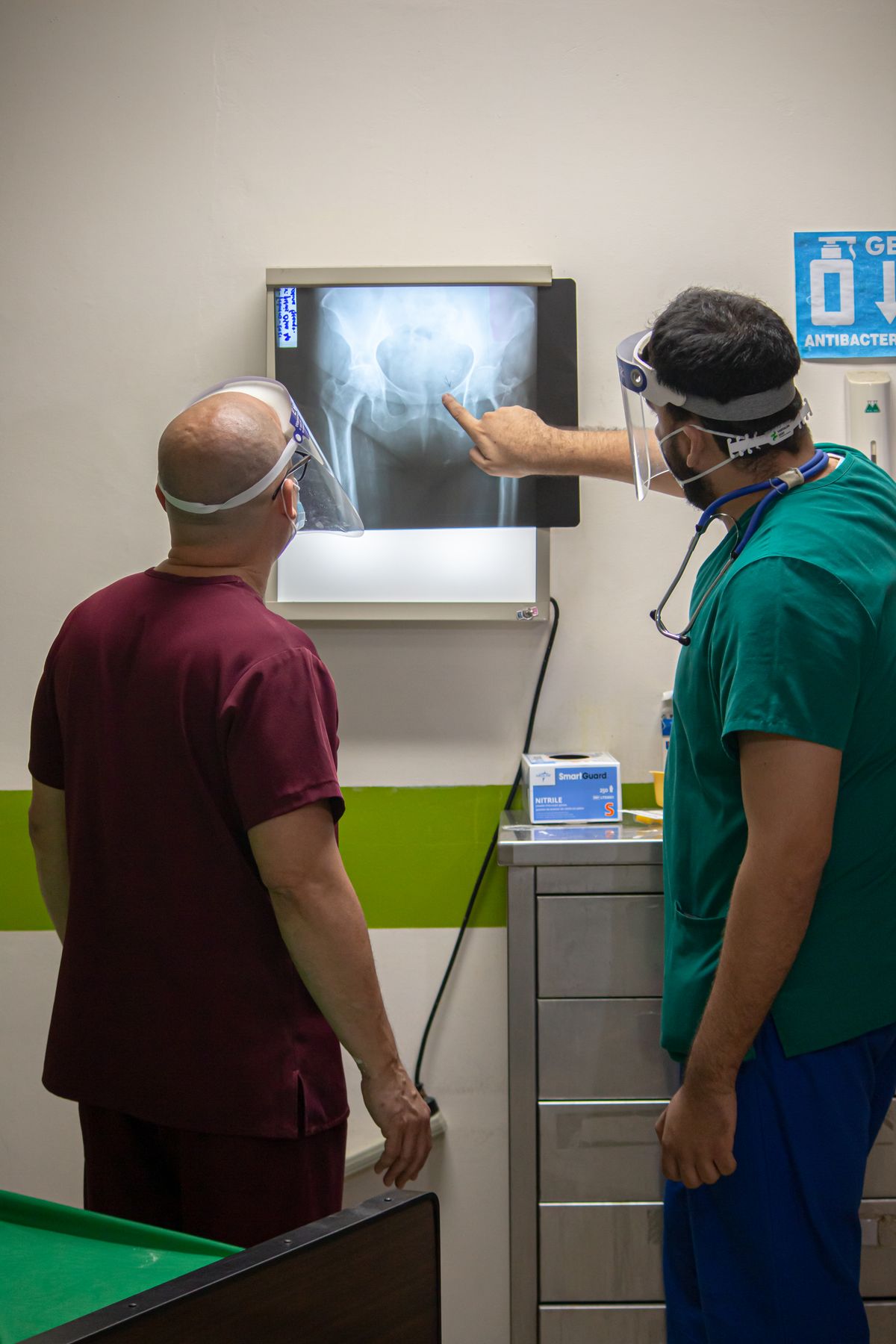 Total Hip Replacement – Unilateral