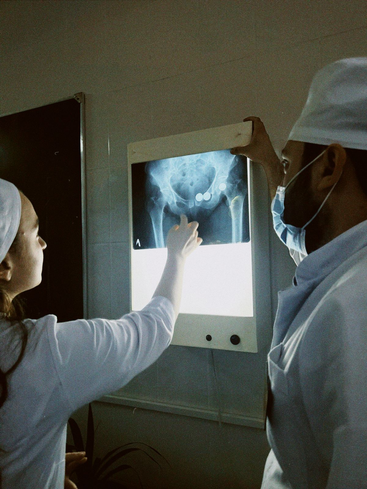 Total Knee Replacement – Bilateral