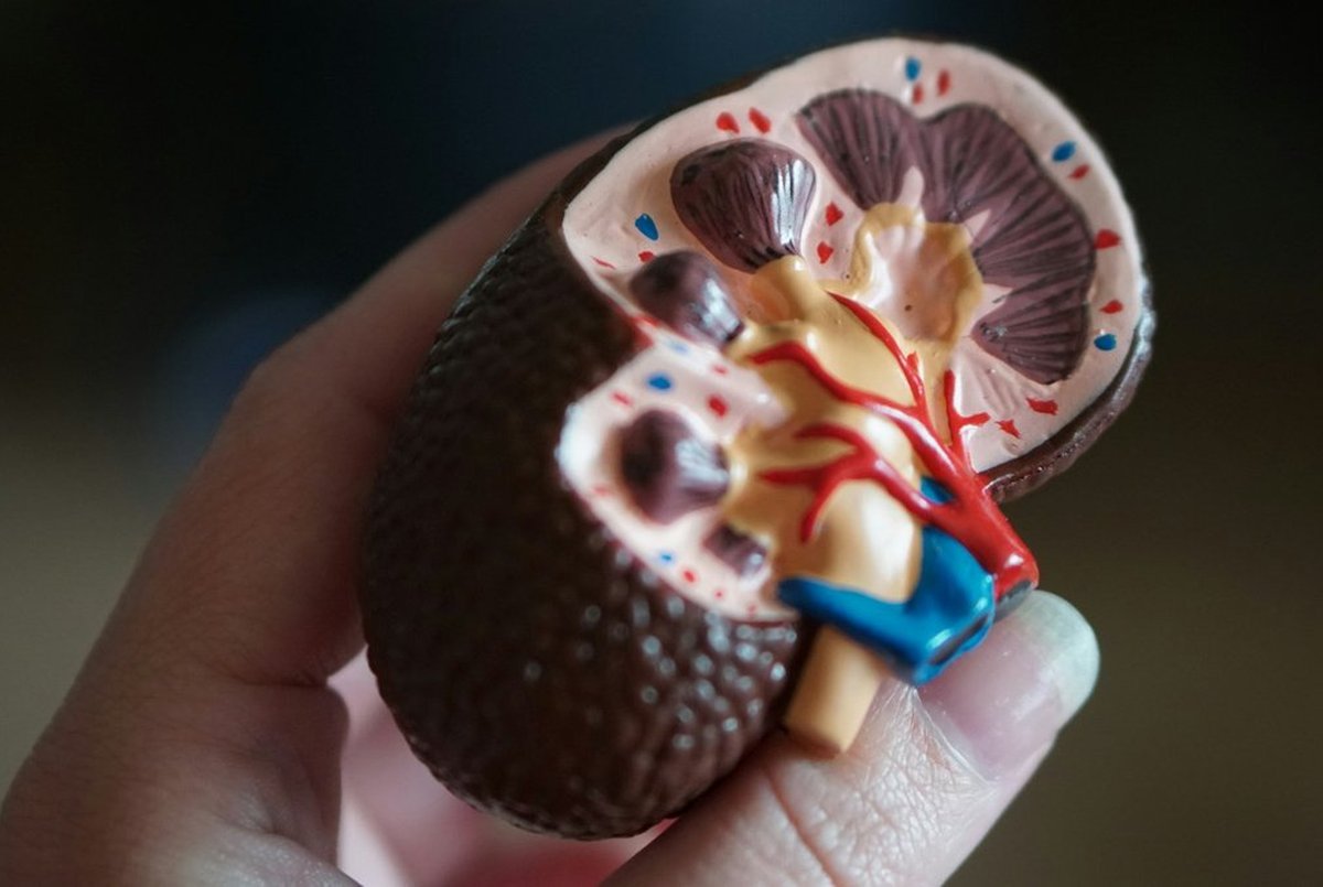 Kidney Transplant