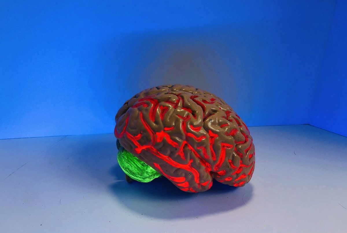 Brain Aneurysm Coiling