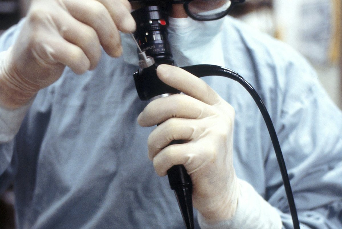 ERCP