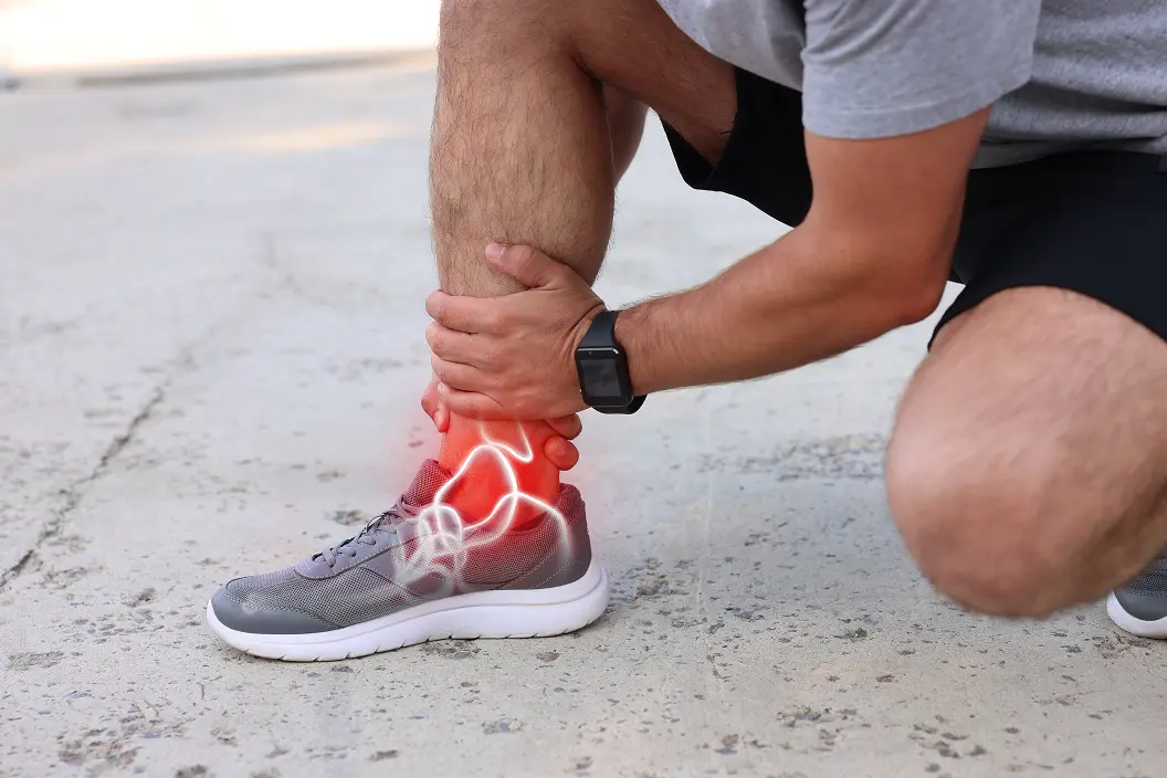 Shin Splints