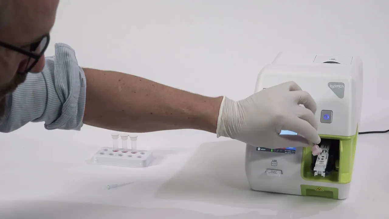 Náhled videa Měření Streptest – ukázka