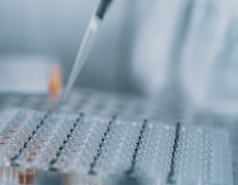 Close-up of a lab technician using a pipette to add liquid to a clear multi-well plate in a laboratory setting.