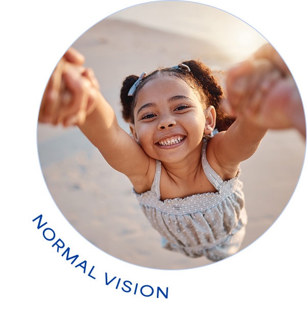 Normal vision